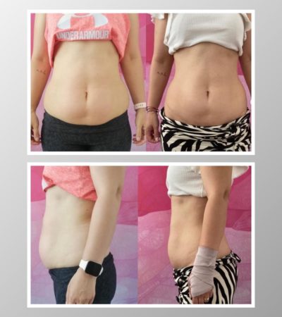 Much-smaller-waist-less-fat-emslim-smaller-400x450