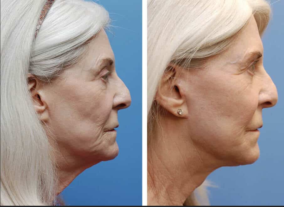 6 Treatments