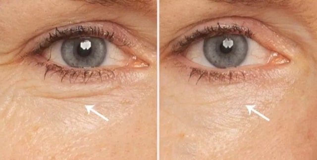 Before After Proline