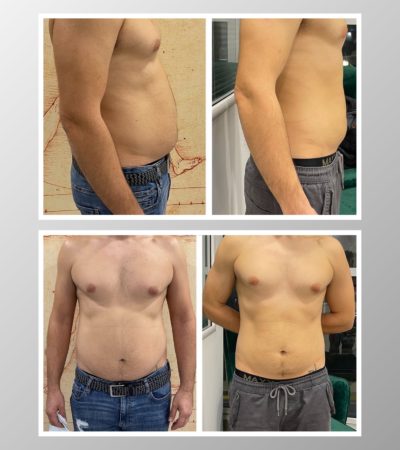 dad-bod-got-so-much-better-400x450
