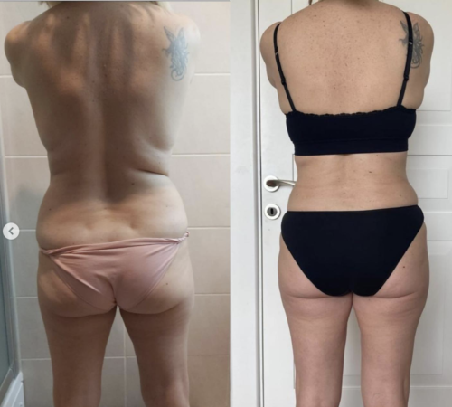 much-better-love-handles-after-contour-500x450
