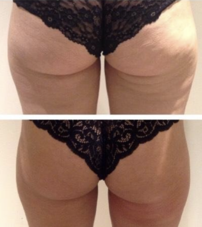much-better-tush-contour-smaller-400x450